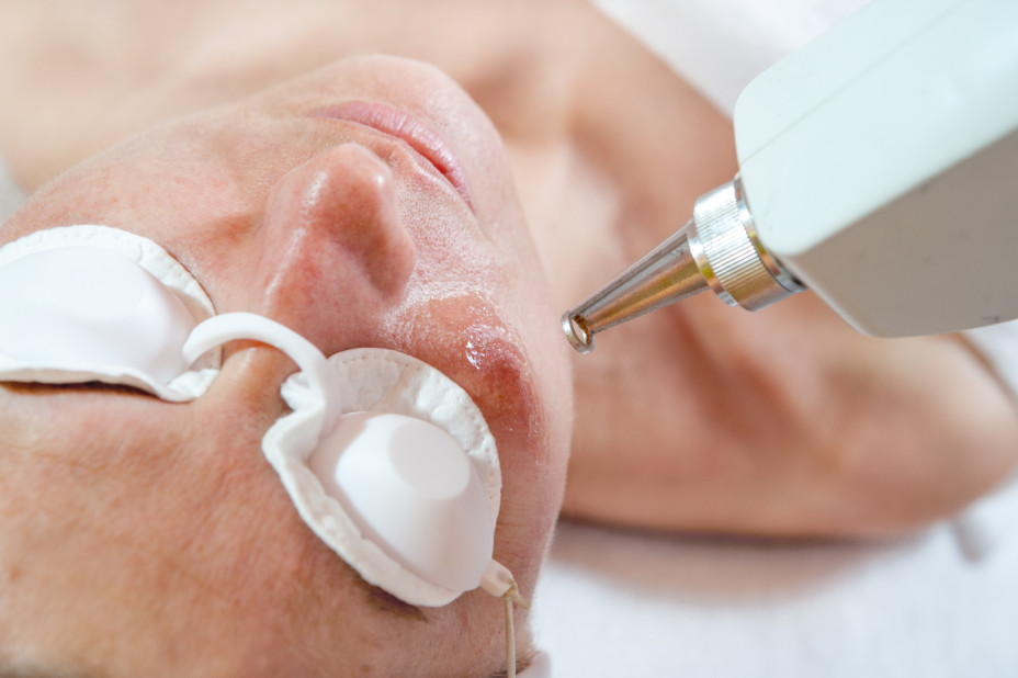 revealing-clinic-SKIN-service